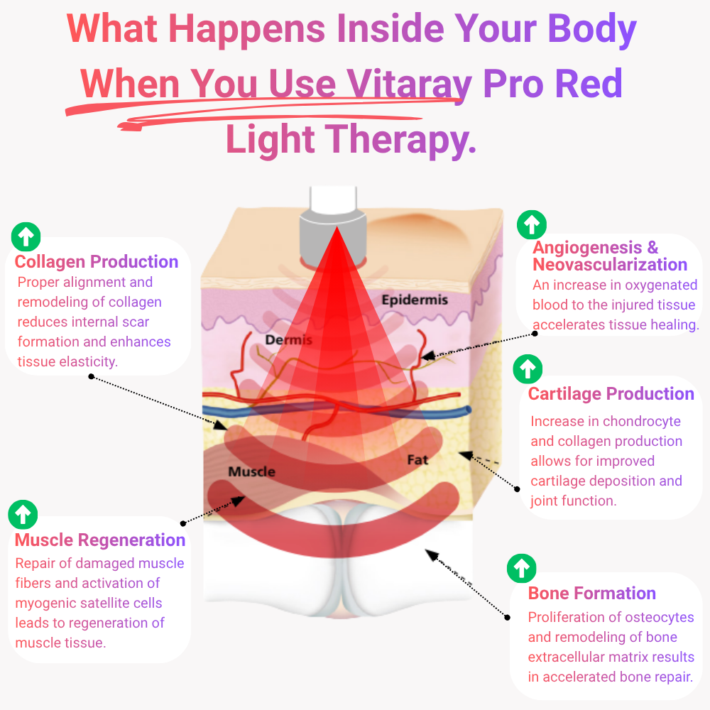 Vitaray Pro (660nm&850nm)