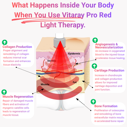 Vitaray Pro (660nm&850nm)
